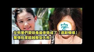 女明星們愛吸毒最後吸成了「這副模樣」      驚悚程度超越整型失敗！