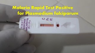 Malaria Rapid Test Positive Demonstration