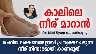 കാലിലെ നീര് നിസാരമായി കാണരുത് | Malayalam Health Tips