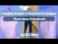 COMPLEX BUNION AND HAMMERTOE SURGERY 3 hour procedure  #footsurgery #footpain #bunion #bunionsurgery