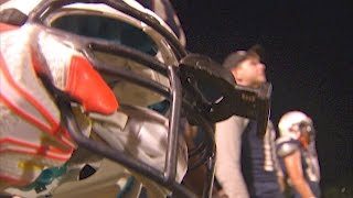Johns Hopkins All Children's Hospital Studies Concussions