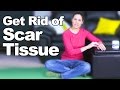 Get Rid of Scar Tissue - Ask Doctor Jo Get Rid of Scar Tissue - Ask Doctor Jo