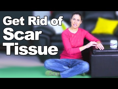 Get Rid of Scar Tissue - Ask Doctor Jo Get Rid of Scar Tissue - Ask Doctor Jo
