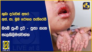 කුඩා දරුවන් අතර අත්, පා, මුඛ රෝගය පැතිරෙයි - ඔබේ පුංචි දුව - පුතා ගැන සැලකිලිමත්වන්න