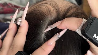 ASMR Long Nails: Dandruff Cleaning & Scalp Scraping (Relax & Sleep Aid)