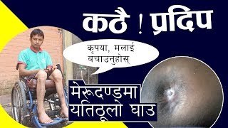 ११ वर्षदेखि यस्तो पिडा खेप्दै प्रदिप || चारतल्लाबाट खसेर मेरुदण्ड भाँचियो || खर्चको चरम अभाव