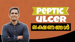 Peptic ulcer ( അൾസർ ) ഒരിക്കലും അവഗണിക്കാൻ പാടില്ലാത്ത  ചില ലക്ഷണങ്ങൾ II Ulcer Malayalam health tips