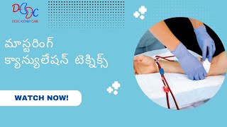 Mastering Cannulation Techniques - Telugu | #dcdc #ttt #nabh #dialysis