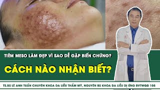 Tiêm meso làm đẹp vì sao dễ gặp biến chứng? Cách nào nhận biết? | SKĐS