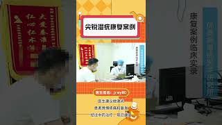 男性尖锐湿疣康复案例——医生建议做激光，患者畏惧疼痛和复发，经过中药治疗，现已康复