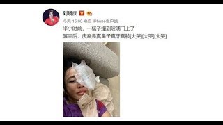 劉曉慶面部意外受傷，感嘆：慶幸是真鼻子真牙真臉 - 藝人故事