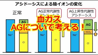 【血ガス】酸塩基平衡を考えるはじめの第一歩　第３話　AG：アニオンギャップを考える！