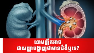 Causes of pollakiuria | នោមញឹកអាចជាសញ្ញាបង្ហាញថាមានជំងឺឬទេ