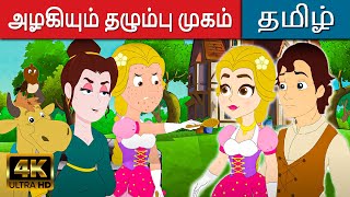 அழகியும் தழும்பு முகம் - Story In Tamil | Kathaigal | Fairy Tales In Tamil |Bedtime Stories In Tamil