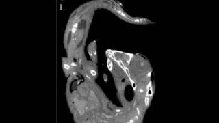 Alligator embryo microCT scan - serial slice animation