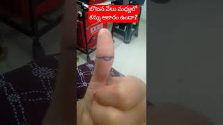 బొటన వేలు మధ్యలో కన్ను ఆకారం ఉందా?