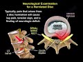 neurological examination for a herniated disc everything you need to know dr. nabil ebraheim