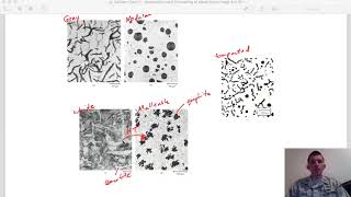 Callister - Chpt 11 - Applications and Processing of Metals