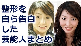 都市伝説　整形を自ら告白した芸能人まとめ　驚愕