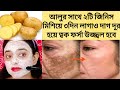 ত্বক হবে দাগহীন  ফর্সা  উজ্জ্বল গ্লোয়িং রাতে মাখো এই  আলুর ক্রিম /remove pigmentation /potato cream