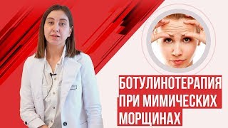 Ботулинотерапия: ботокс, диспорт, ксеомин при мимических морщинах