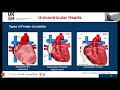 Medis MR webinar: Cardiac Function is about measuring volume and more