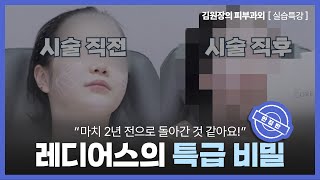 필러와 180도 다른 레디어스! | 시술 전 알아야 할 3가지