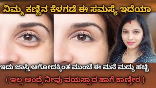 ಕಣ್ಣ ಕೆಳಗೆ ಊತ ಆದರೆ ಚಿಂತಿಸಬೇಡಿ ಬರೆ 5 ನಿಮಿಷದಲ್ಲಿ ಇದನ್ನು ಸರಿ ಮಾಡಲು ಆಗುತ್ತದೆ 💯 ಈ ಮನೆ ಮದ್ದಿನಿಂದ ಹೋಗುತ್ತೆ