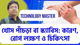 Scabies: Cause, Symptoms \u0026 Treatment খোস পাঁচড়া বা স্ক্যাবিস: কারণ, রোগ লক্ষণ এবং চিকিৎসা