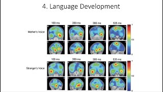 13.4. Language Brain Development, Fundamentals of Cognitive Neuroscience Course, Session 13, Part 4