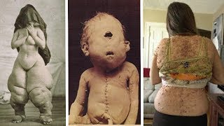 5 Disturbing Medical Images from History - 10 disturbing medical images from history  / жесть