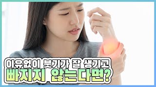 림프부종을 개선하는 방법 : 림프계의 펌프를 이용해 보세요