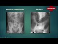 abdominal x ray interpretation for medical students