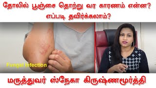 தோலில் பூஞ்சை தொற்று வர காரணம் என்ன? எப்படி தவிர்க்கலாம்? | Dr.சினேகா கிருஷ்ணமூர்த்தி | Beauty tips