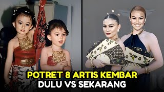 Bikin Pangling, 8 Potret Artis Kembar Dulu dan Sekarang