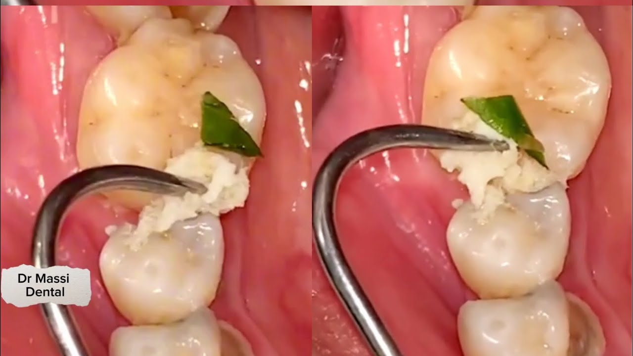 Brush Your Teeth Youtube