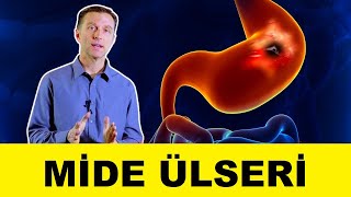 Mide ülserlerinden nasıl kurtulur? Peptik ülser tedavisi | Dr.Berg Türkçe