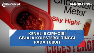 Kenali 5 Ciri ciri Gejala Kolesterol Tinggi pada Tubuh