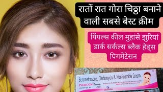 रातों रात गोरा चिट्ठा बनाने वाली क्रीम l पिंपल्स कील मुंहासों  l face beauty tips l Dr Jitendra ji