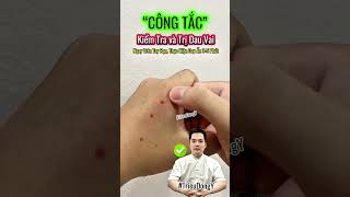 Shoulder Pain Press This Acupuncture Point Immediately ❤️ #truyeny #trieuuvltl #trieudongduoc