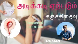 அடிக்கடி ஏற்படும் கருச்சிதைவு #threatened #abortion #frequent #doctor #homoeopathy #madurai #chennai