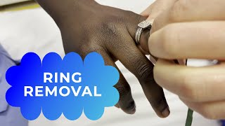 How to get a stuck ring off a swollen finger (ring removal)