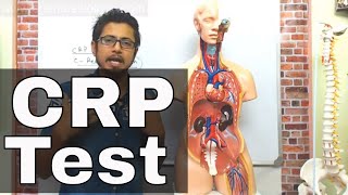 CRP test procedure in Hindi