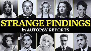 WEIRD Things Found In Celebrity Autopsy Reports (Golden Era Edition)