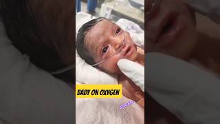 Baby On Oxygen Nasal support #shorts #viral #short #baby #oxygen #youtube