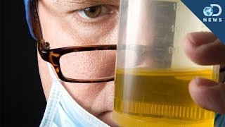 Is It Safe To Drink Your Urine?