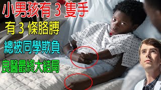 小男孩有3隻手，3條胳膊，總被同學欺負，神醫開大招“死神退位”救治，良醫最終大結局！