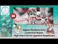 High Utero-Sacral ligament Suspension with vaginal hysterectomy | Enterocoele repair | MUG