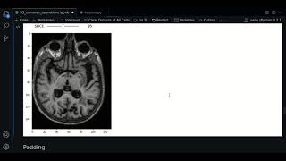 2.2 - Cropping | SimpleITK - Course MRI preprocessing with Python