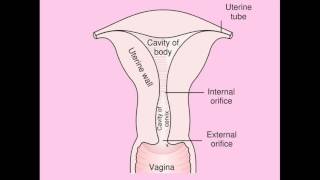 Benign Cervical Lesions - CRASH! Medical Review Series